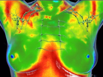 borst thermografie