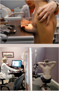 Vergelijking tussen mammografie en infrarood thermografie